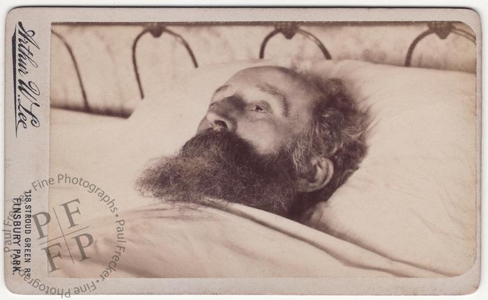Bearded man with open eyes