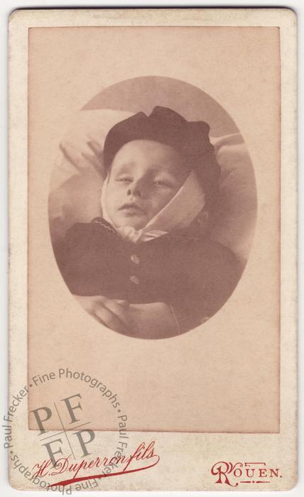 Boy with bandaged head