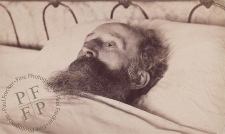 Bearded man with open eyes