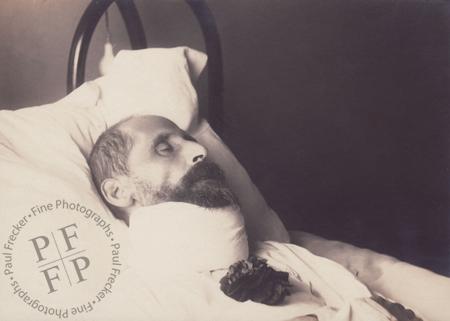 Man with a bandaged neck